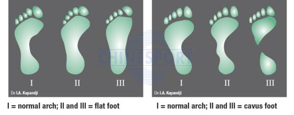 LUX Podoscope – Advanced Foot Posture & Pressure Analysis Tool