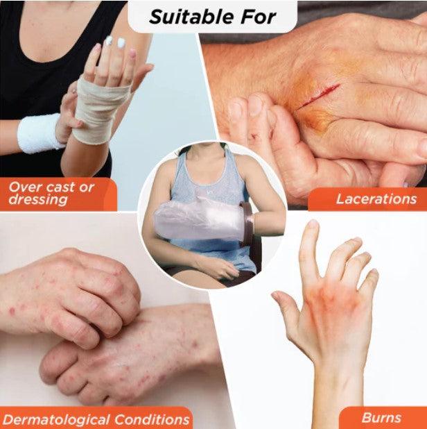 Cast Cover for Left & Right Hand| Protects Bandage from Water Exposure during Bath & Shower - Health Mart